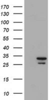 Western Blot: Proteasome 20S alpha 6 Antibody (OTI4C9) [NBP2-03836]