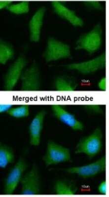 Immunocytochemistry/ Immunofluorescence: Proteasome 20S alpha 6 Antibody [NBP1-32406]