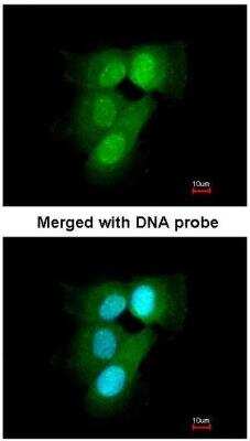 Immunocytochemistry/ Immunofluorescence: Proteasome 20S alpha 6 Antibody [NBP1-33538]