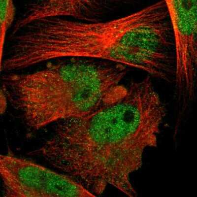 Immunocytochemistry/ Immunofluorescence: Proteasome 20S alpha 6 Antibody [NBP1-87796]