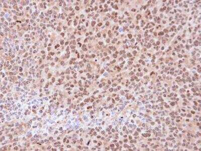 Immunohistochemistry-Paraffin: Proteasome 20S alpha 6 Antibody [NBP1-33538]