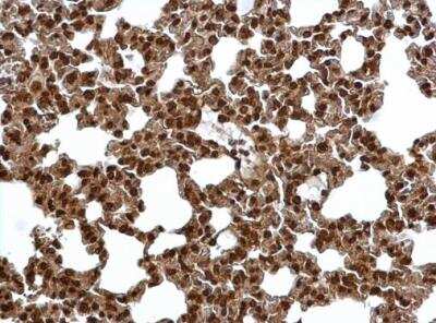Immunohistochemistry-Paraffin: Proteasome 20S alpha 6 Antibody [NBP1-33538]