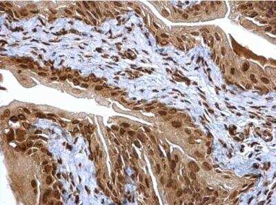 Immunohistochemistry-Paraffin: Proteasome 20S alpha 6 Antibody [NBP1-33538]