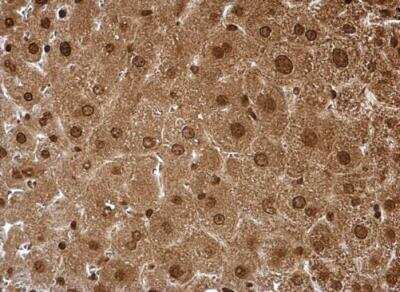 Immunohistochemistry-Paraffin: Proteasome 20S alpha 6 Antibody [NBP1-33538]
