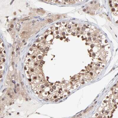 Immunohistochemistry-Paraffin: Proteasome 20S alpha 6 Antibody [NBP1-87796]