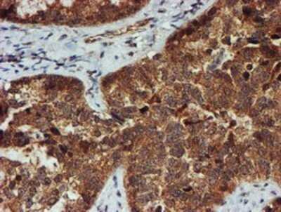 Immunohistochemistry: Proteasome 20S alpha 6 Antibody (OTI4C9) - Azide and BSA Free [NBP2-73637]
