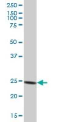 Western Blot: Proteasome 20S alpha 6 Antibody [H00005687-B01P]