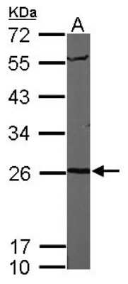Western Blot: Proteasome 20S alpha 6 Antibody [NBP1-32406]