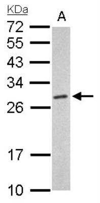 Western Blot: Proteasome 20S alpha 6 Antibody [NBP1-33538]