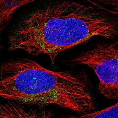 Immunocytochemistry/ Immunofluorescence: Proteasome 20S beta 3 Antibody [NBP2-33380]