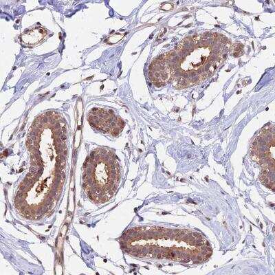 Immunohistochemistry: Proteasome 20S beta 3 Antibody [NBP2-33380]