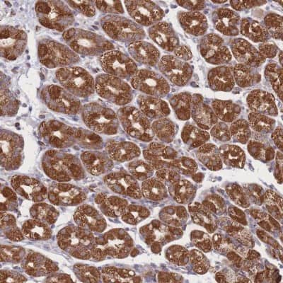 Immunohistochemistry-Paraffin: Proteasome 20S beta 3 Antibody [NBP2-33516]