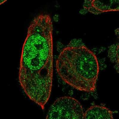 Immunocytochemistry/ Immunofluorescence: Proteasome 20S beta 6 Antibody [NBP2-57831]