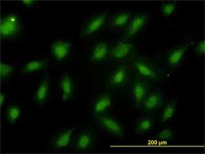 Immunocytochemistry/ Immunofluorescence: Proteasome 20S beta 6 Antibody (S51) [H00005694-M02]