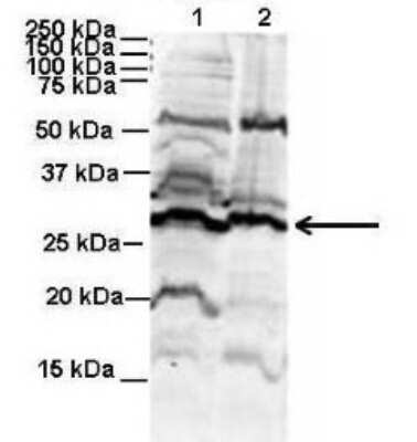 Western Blot: Proteasome 20S beta 6 Antibody [NBP1-56575]