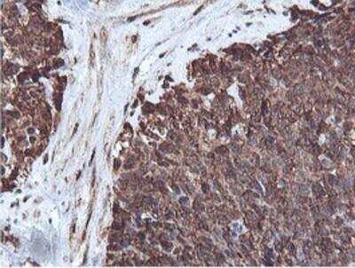 Immunohistochemistry-Paraffin: PSMB7 Antibody (OTI1E1) [NBP2-01832]
