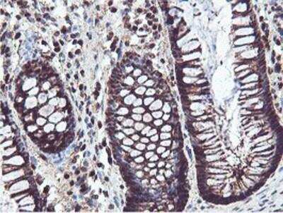 Immunohistochemistry-Paraffin: PSMB7 Antibody (OTI1E1) [NBP2-01832]