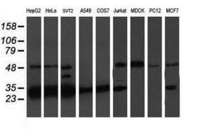 Western Blot: PSMB7 Antibody (OTI1E1) [NBP2-01832]