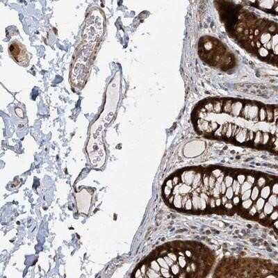 Immunohistochemistry-Paraffin: PSMB7 Antibody [NBP2-13821]