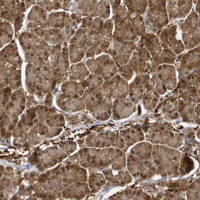 Immunohistochemistry-Paraffin: PSMB7 Antibody [NBP2-13821]