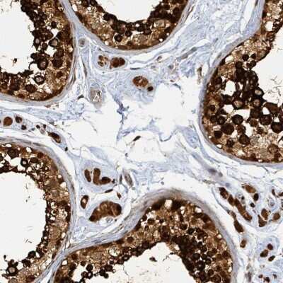 Immunohistochemistry-Paraffin: PSMB7 Antibody [NBP2-13821]