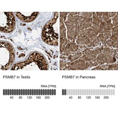 Immunohistochemistry-Paraffin: PSMB7 Antibody [NBP2-13821]