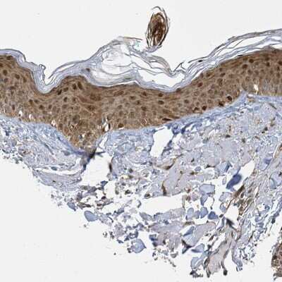 Immunohistochemistry-Paraffin: PSMB7 Antibody [NBP2-13821]