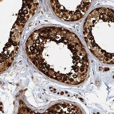 Immunohistochemistry-Paraffin: PSMB7 Antibody [NBP2-13821]