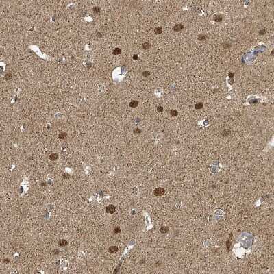 Immunohistochemistry-Paraffin: PSMB7 Antibody [NBP2-13821]