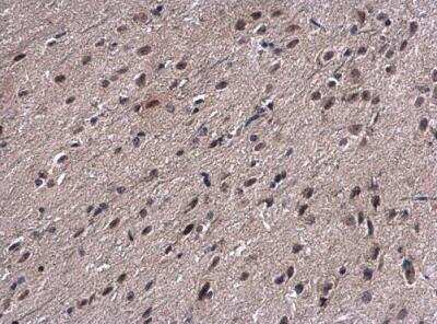 Immunohistochemistry-Paraffin: PSMB7 Antibody [NBP2-19954]