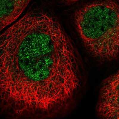 Immunocytochemistry/ Immunofluorescence: Proteasome 20S beta2 Antibody [NBP1-92294]