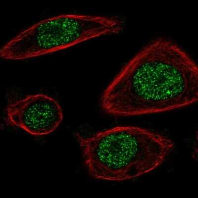 Immunocytochemistry/ Immunofluorescence: Proteasome 20S beta2 Antibody [NBP1-92295]