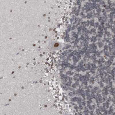 Immunohistochemistry-Paraffin: Proteasome 20S beta2 Antibody [NBP1-92295]