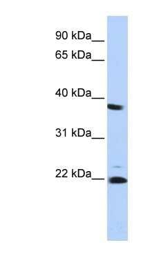 Western Blot: Proteasome 20S beta2 Antibody [NBP1-54589]