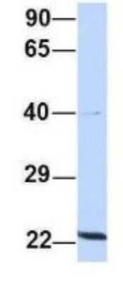 Western Blot: Proteasome 20S beta2 Antibody [NBP1-54589]
