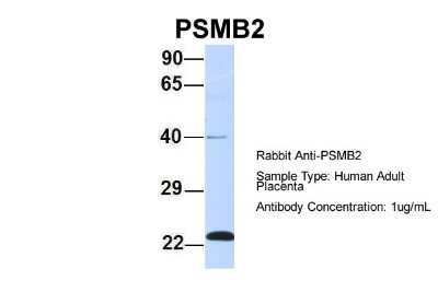 Western Blot: Proteasome 20S beta2 Antibody [NBP1-54589]