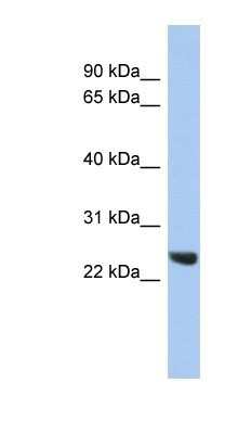 Western Blot: Proteasome 20S beta2 Antibody [NBP1-54590]