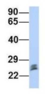 Western Blot: Proteasome 20S beta2 Antibody [NBP1-54590]