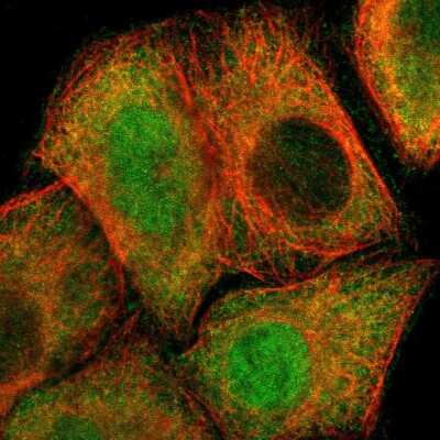 Immunocytochemistry/ Immunofluorescence: Proteasome 26S S5 Antibody [NBP1-87800]