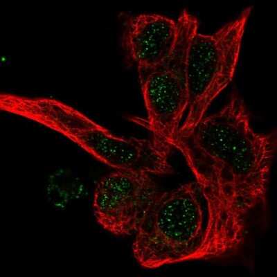Immunocytochemistry/ Immunofluorescence: Proteasome beta 1 Antibody [NBP1-89714]