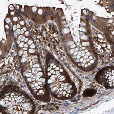 Immunohistochemistry-Paraffin: Proteasome beta 1 Antibody [NBP1-89713]