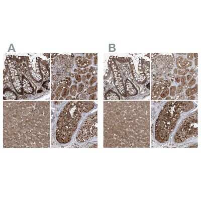 Immunohistochemistry-Paraffin: Proteasome beta 1 Antibody [NBP1-89713]