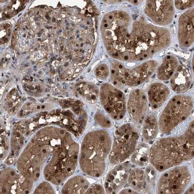 Immunohistochemistry-Paraffin: Proteasome beta 1 Antibody [NBP1-89713]