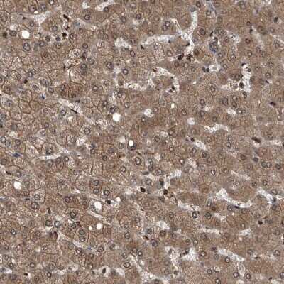 Immunohistochemistry-Paraffin: Proteasome beta 1 Antibody [NBP1-89713]
