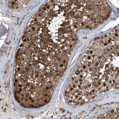 Immunohistochemistry-Paraffin: Proteasome beta 1 Antibody [NBP1-89713]
