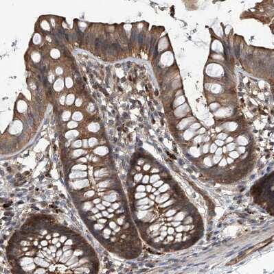 Immunohistochemistry-Paraffin: Proteasome beta 1 Antibody [NBP1-89714]