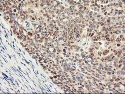 Immunohistochemistry-Paraffin: Proteasome subunit beta type 4 Antibody (OTI2C9) [NBP2-01225]