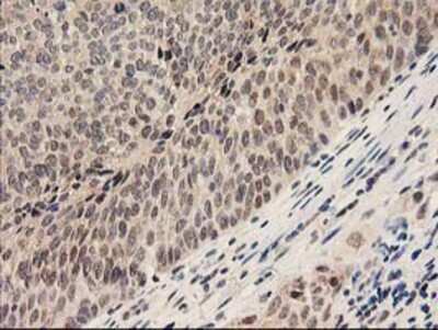 Immunohistochemistry-Paraffin: Proteasome subunit beta type 4 Antibody (OTI2C9) [NBP2-01225]