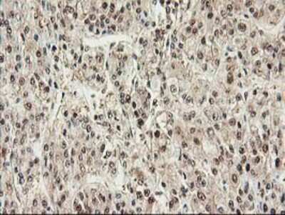 Immunohistochemistry-Paraffin: Proteasome subunit beta type 4 Antibody (OTI2C9) [NBP2-01225]