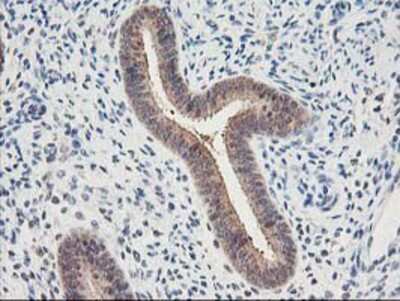 Immunohistochemistry-Paraffin: Proteasome subunit beta type 4 Antibody (OTI2C9) [NBP2-01225]